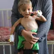 ABD’nin Veto Yetkisi ile Kilitlediği BM, İstatistik Kurumu Gibi Çalışıyor: Gazze’de Akut Yetersiz Beslenmenin 3 Katına Çıktığını Açıkladı