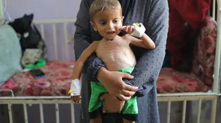 ABD’nin Veto Yetkisi ile Kilitlediği BM İstatistik Kurumu Gibi Çalışıyor: Gazze’de Akut Yetersiz Beslenmenin 3 Katına Çıktığını Açıkladı