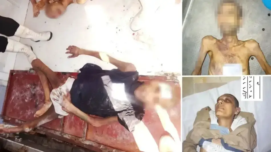 Katil Esed’in On Binden Fazla Suriyeliyi İşkence ile Öldürdüğüne Dair 70 Binden Fazla Fotoğraf Ortaya Çıktı