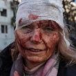 Rusya Ukrayna'nın Kentlerini Tek Tek Vuruyor