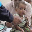 Yemen'de 20 Milyon Kişi Açlıkla Mücadele Ediyor